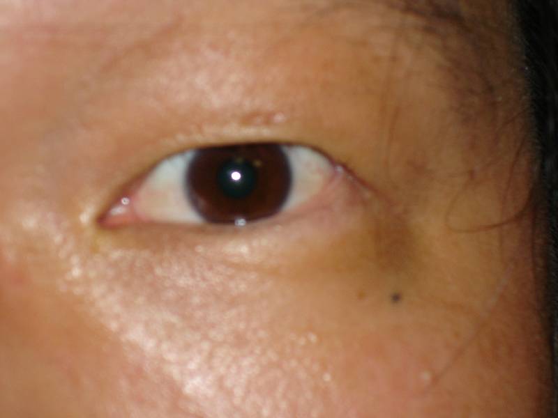 Original image
